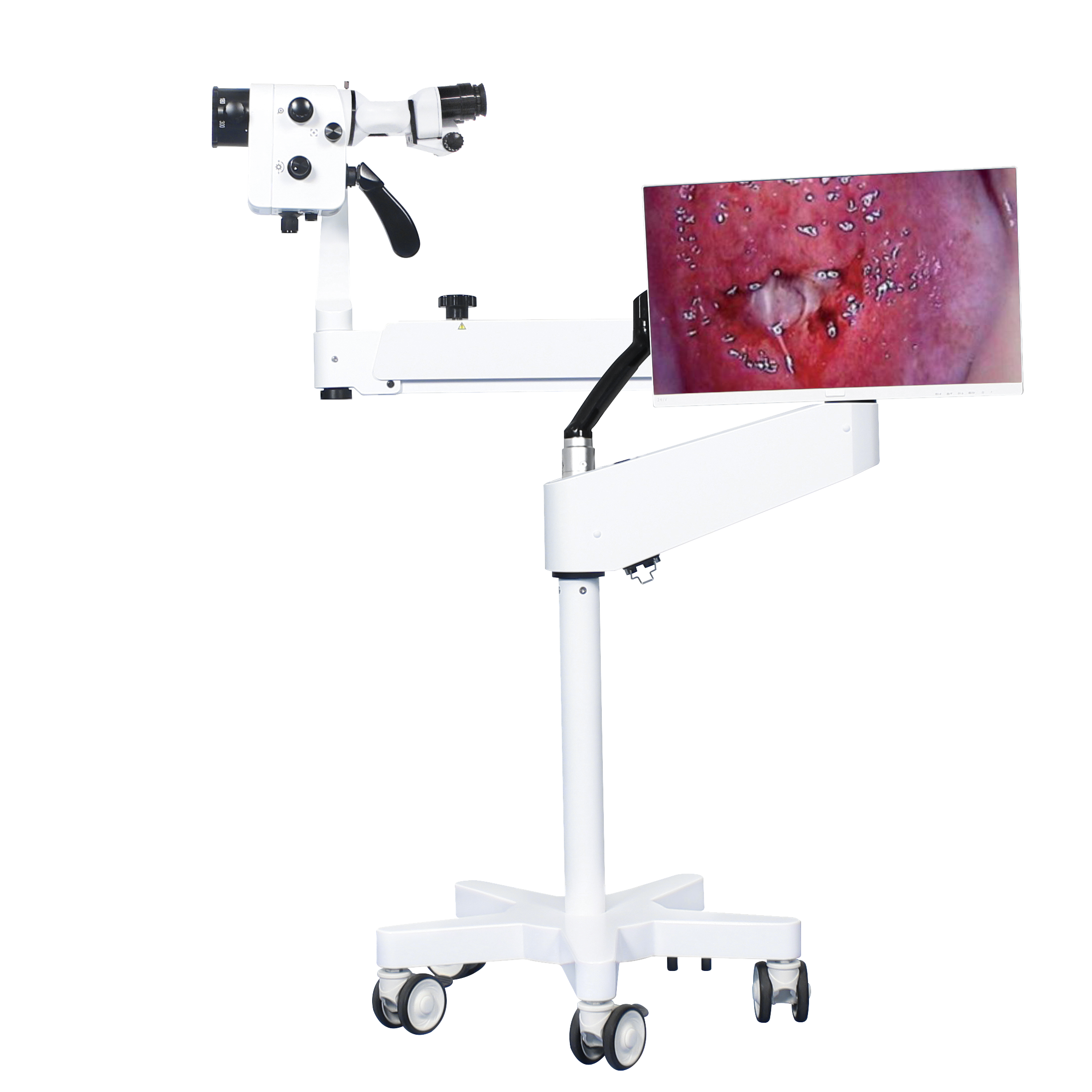 https://www.vipmicroscope.com/portable-optical-colposcopy-for-gynecological-examination-product/